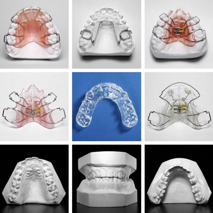 Types d'appareils dentaires en orthodontie